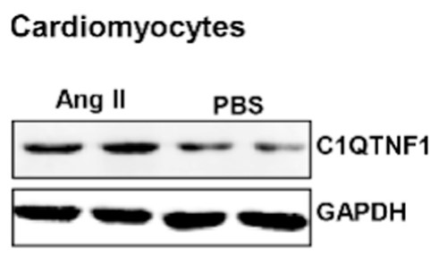 expression of C1QTNF1.jpg